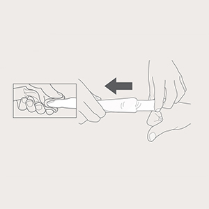 1. trin i appliceringen af Tubinette med fingertut