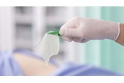Exufiber humide tenu avec une pincette